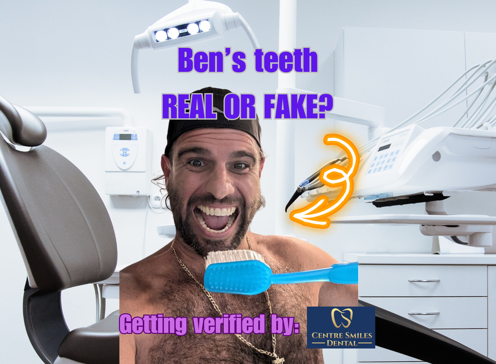 Ben's Teeth- Real or Fake? post image